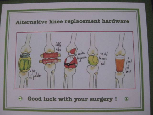 Knee replacement hardware/knee surgery