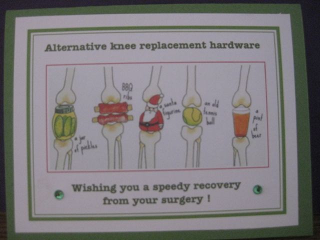 knee surgery hardware