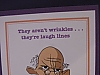 Wrinkles/laugh lines
